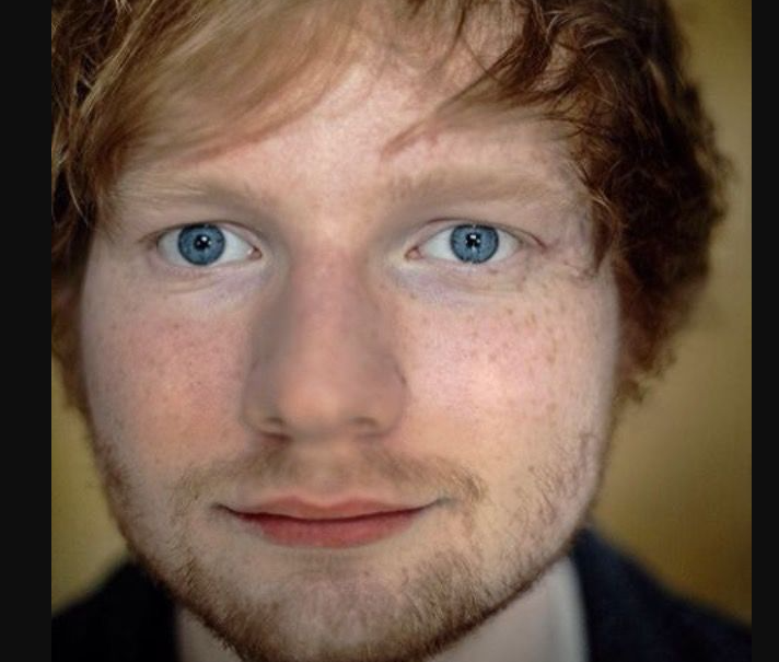 Ed sheerans eyes4