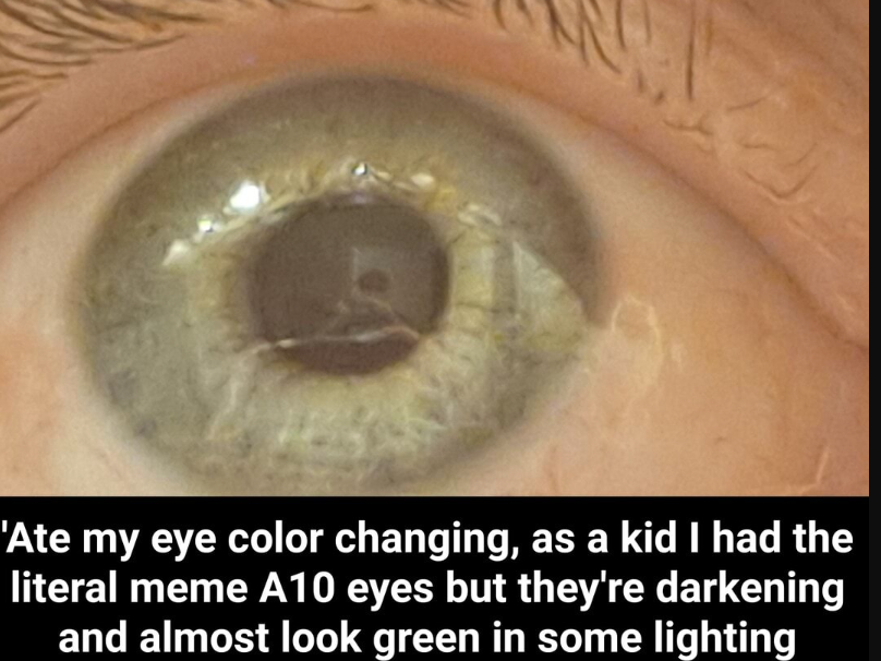 A10 eyes8